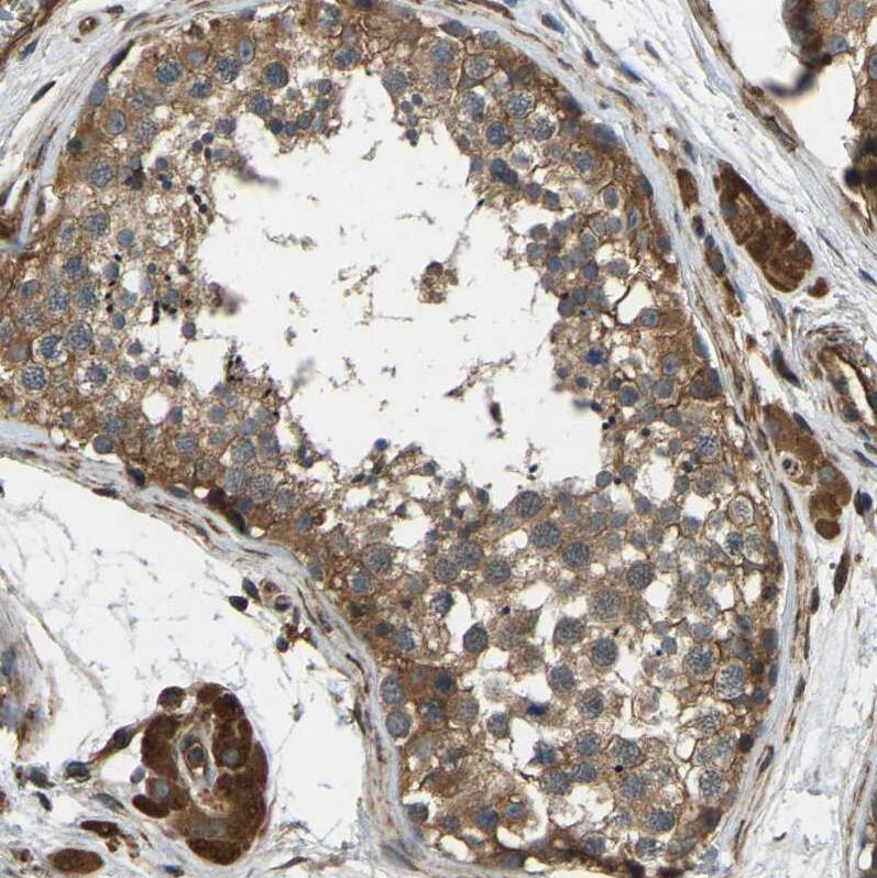Staining of human testis shows moderate to strong cytoplasmic positivity in cells in seminiferous ducts.