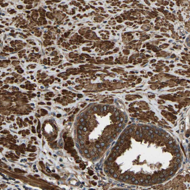 Staining of human prostate shows strong cytoplasmic positivity in smooth muscle cells) and glandular cells).