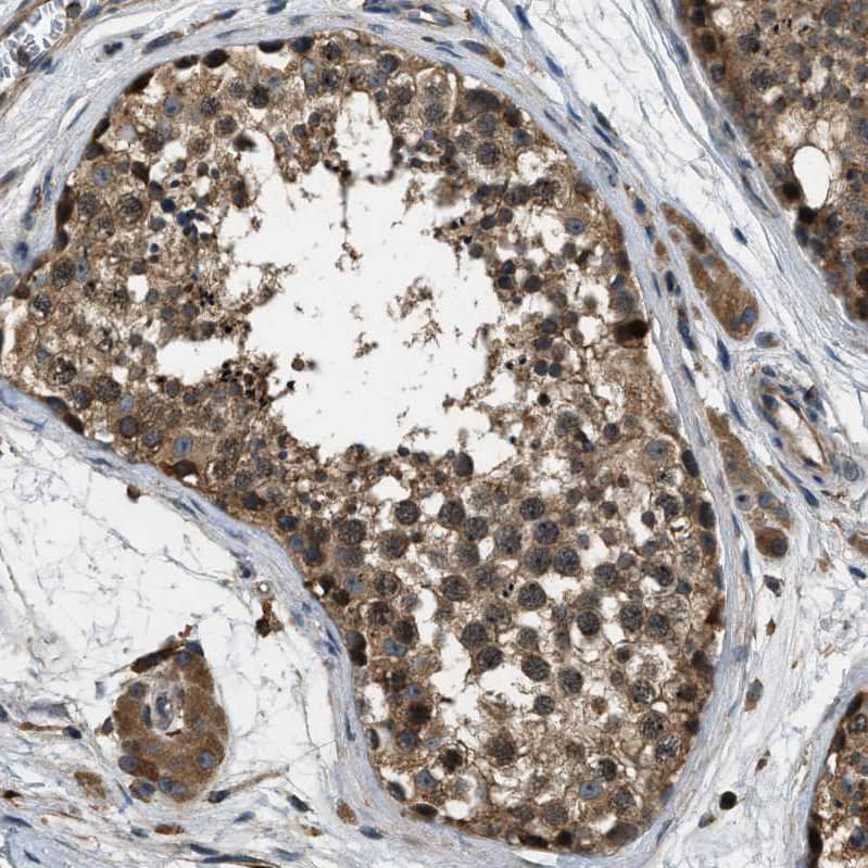Staining of human testis shows moderate to strong cytoplasmic positivity in cells in seminiferous ducts.