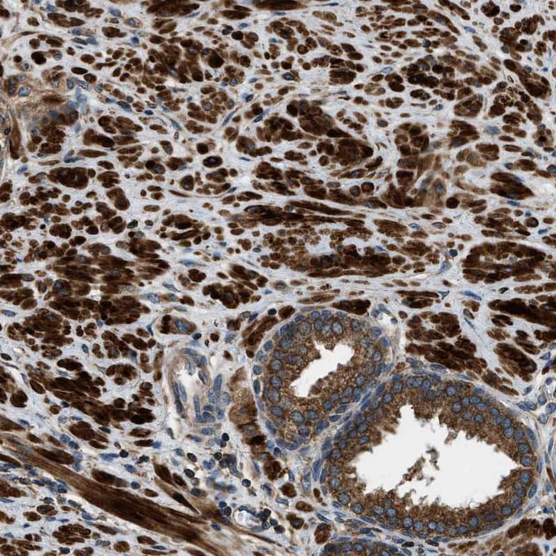 Staining of human prostate shows strong cytoplasmic positivity in smooth muscle cells and glandular cells.