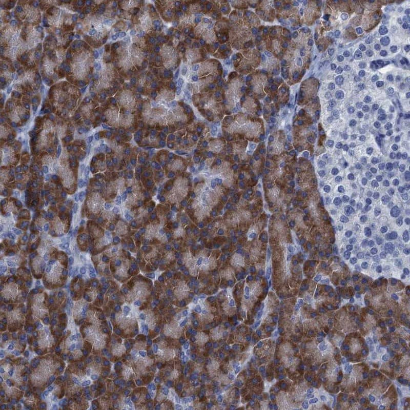 Immunohistochemistry-Paraffin C10orf88 Antibody - BSA Free