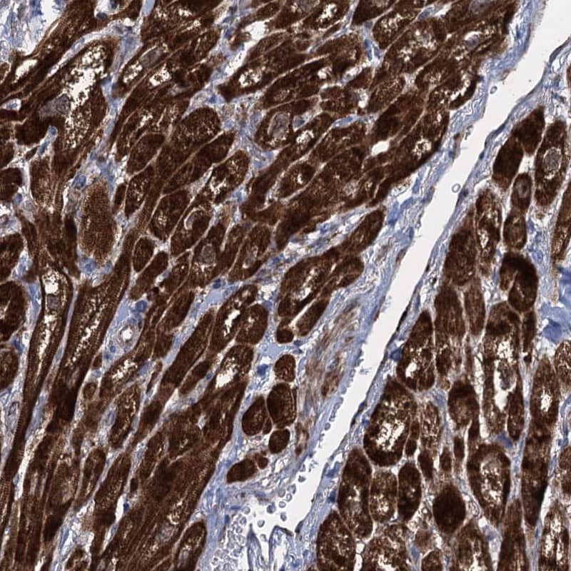 Staining of human heart muscle shows strong cytoplasmic positivity in myocytes.