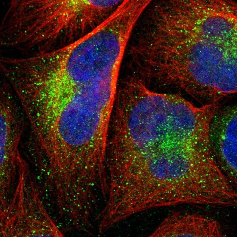 Staining of human cell line U-2 OS shows localization to vesicles.