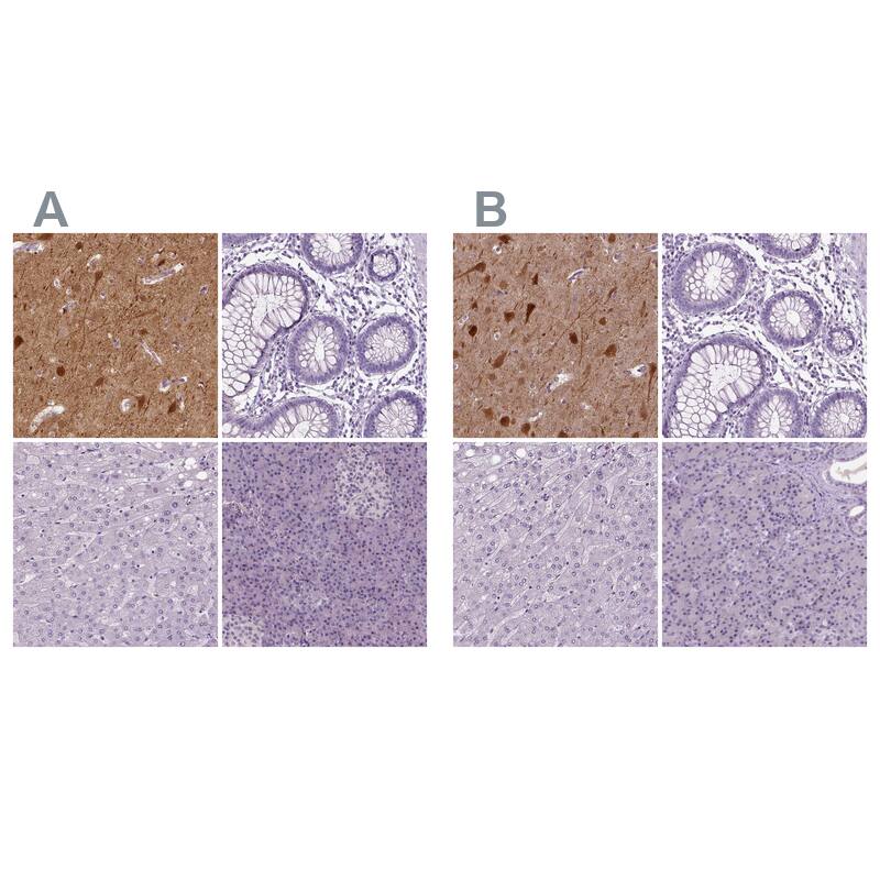 <b>Orthogonal Strategies Validation. </b>Staining of human cerebral cortex, colon, liver and pancreas HPA025963 (A) shows similar protein distribution across tissues to independent antibody HPA023629 (B).