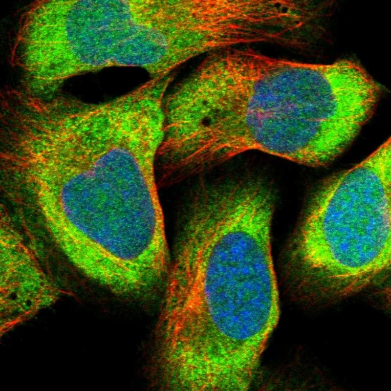 Staining of human cell line U-2 OS shows localization to cytosol.
