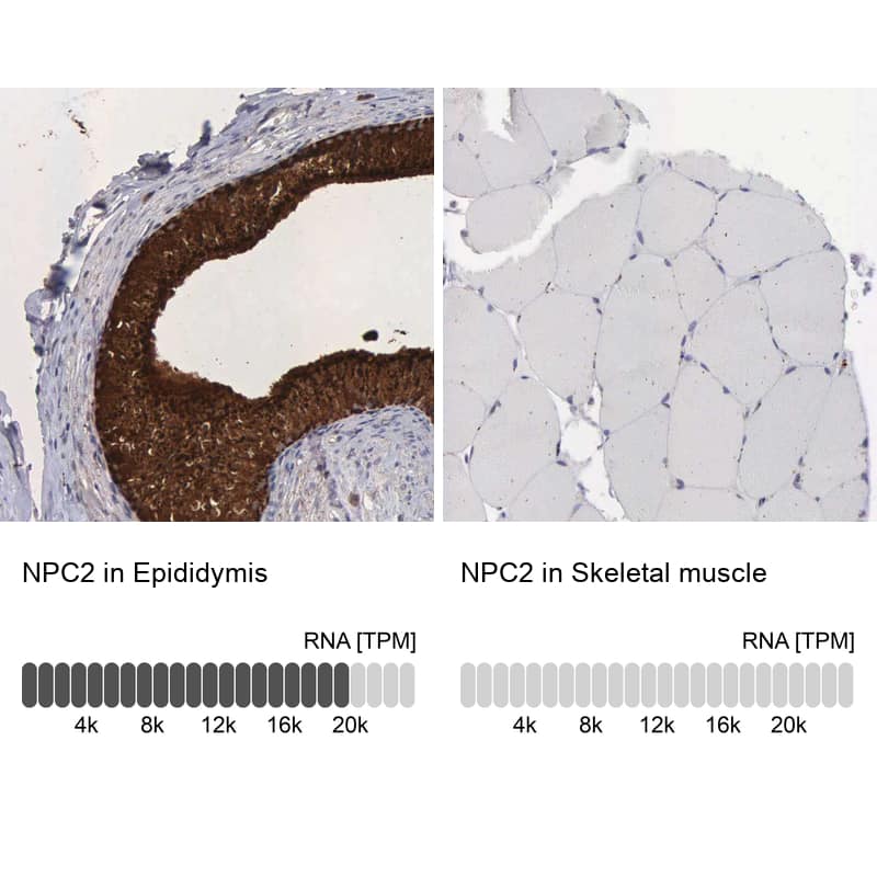 Analysis in human epididymis and skeletal muscle tissues using NBP1-84012 antibody. Corresponding NPC2 RNA-seq data are presented for the same tissues.