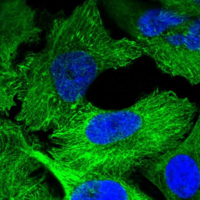 Staining of human cell line U-251 MG shows localization to cytosol, intermediate filaments & focal adhesion sites.