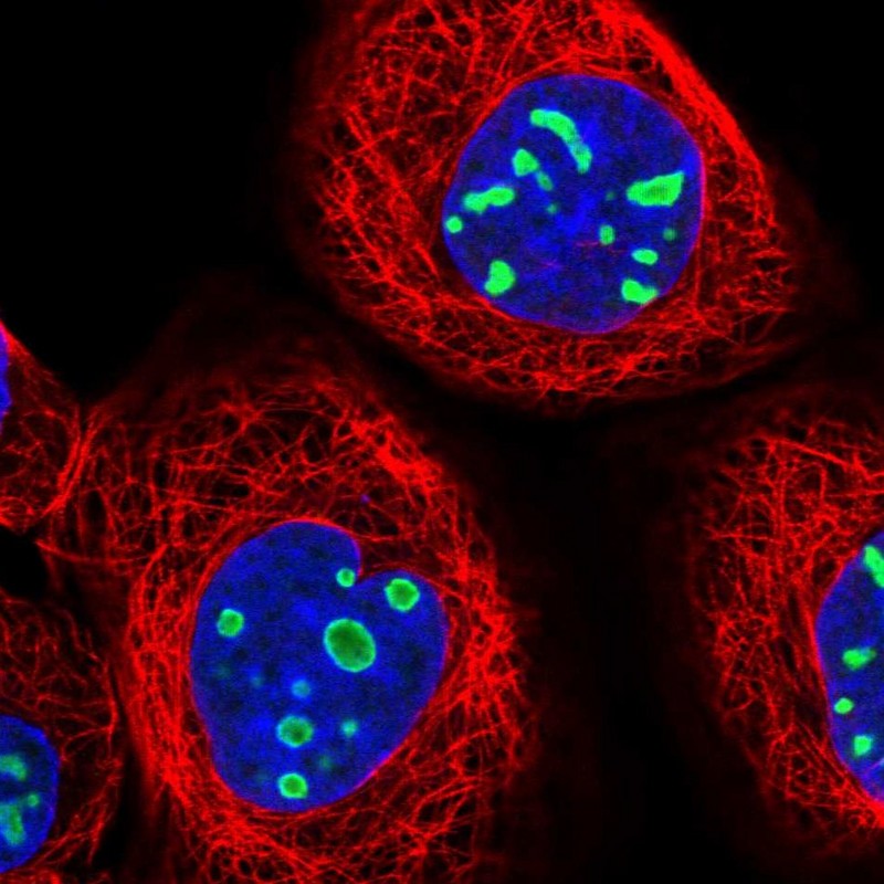 Immunocytochemistry/ Immunofluorescence EBNA1BP2 Antibody - BSA Free