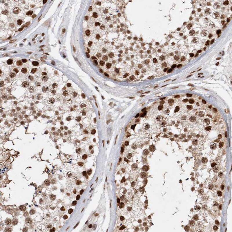 Immunohistochemistry-Paraffin EYA2 Antibody - BSA Free
