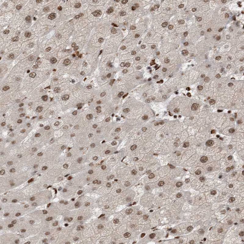 Staining of human liver shows weak to moderate nuclear positivity in hepatocytes.