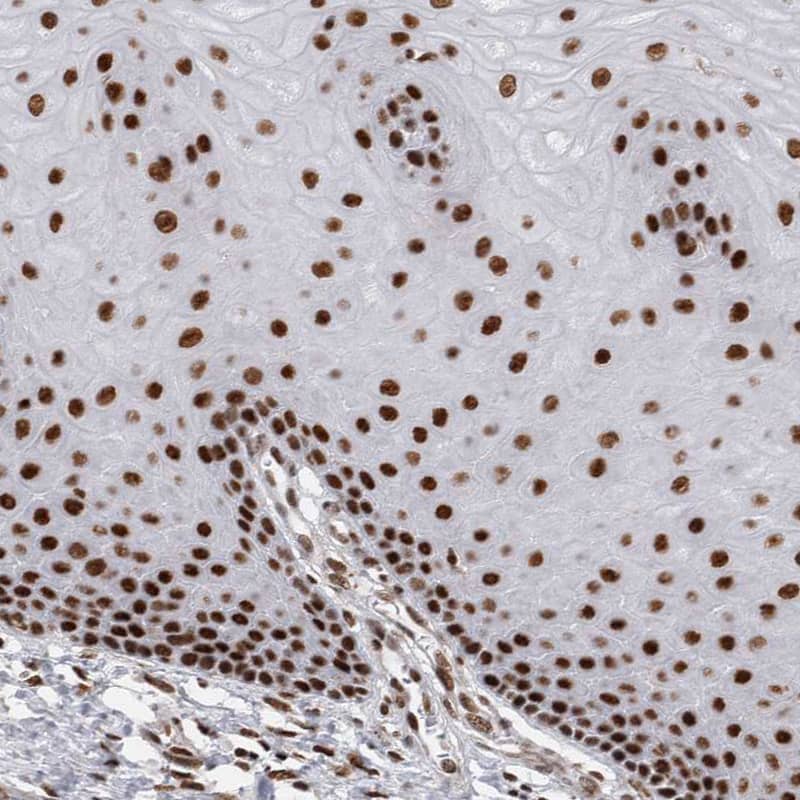 Staining of human cervix, uterine shows strong nuclear positivity in squamous epithelial cells.