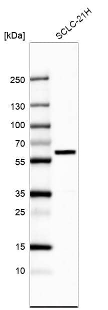 Analysis in human cell line SCLC-21H.