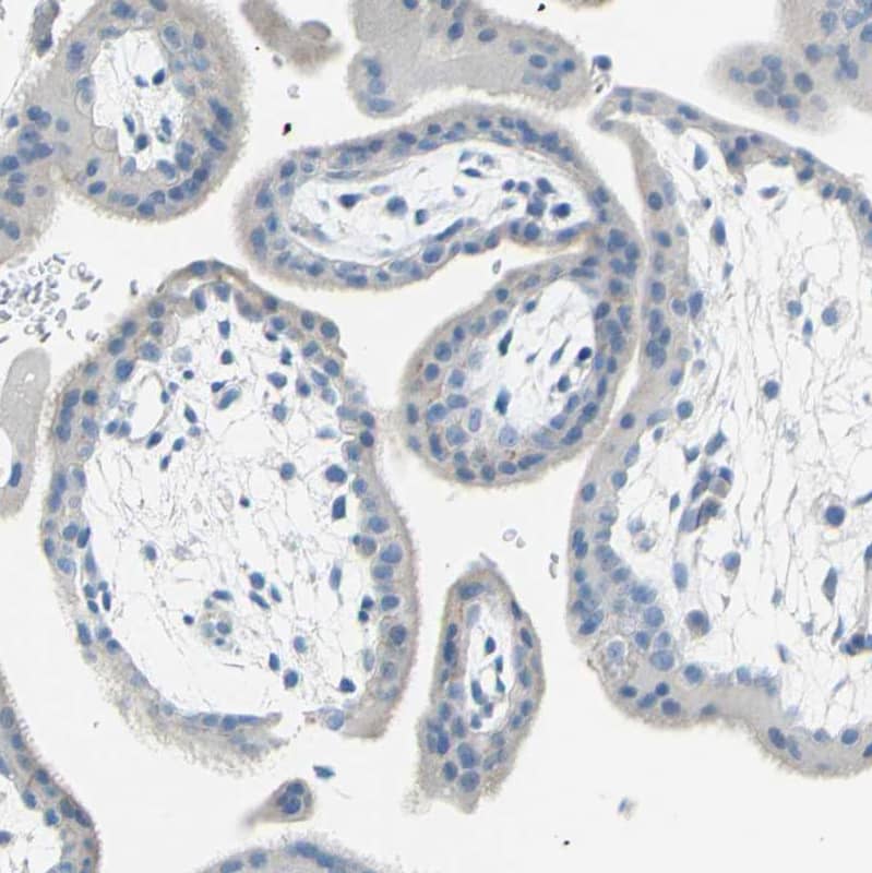 Staining of human placenta shows no positivity in trophoblastic cells as expected.