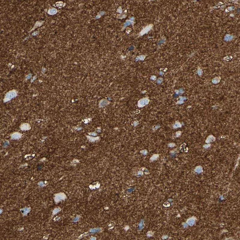 Staining of human cerebral cortex shows strong membranous positivity in neuropil.