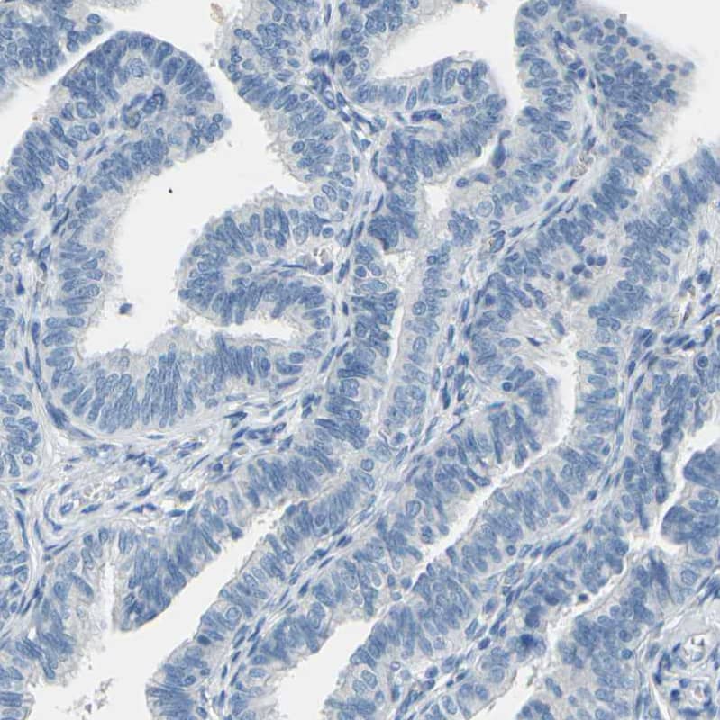 Staining of human Fallopian tube shows no positivity in glandular cells as expected.