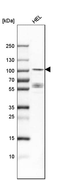 Analysis in human cell line HEL.