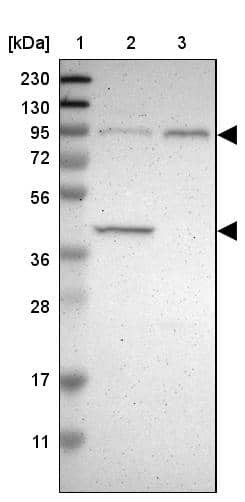 Lane 1: Marker [kDa] 230, 130, 95, 72, 56, 36, 28, 17, 11Lane 2: Human cell line RT-4Lane 3: Human cell line U-251MG sp