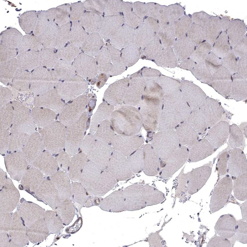 Staining of human skeletal muscle shows very weak cytoplasmic positivity in myocytes.