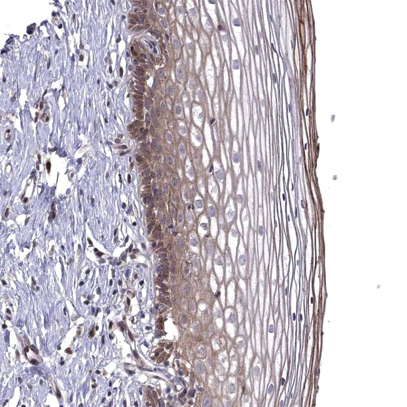 Staining of human cervix, uterine shows moderate cytoplasmic positivity in squamous epithelial cells.