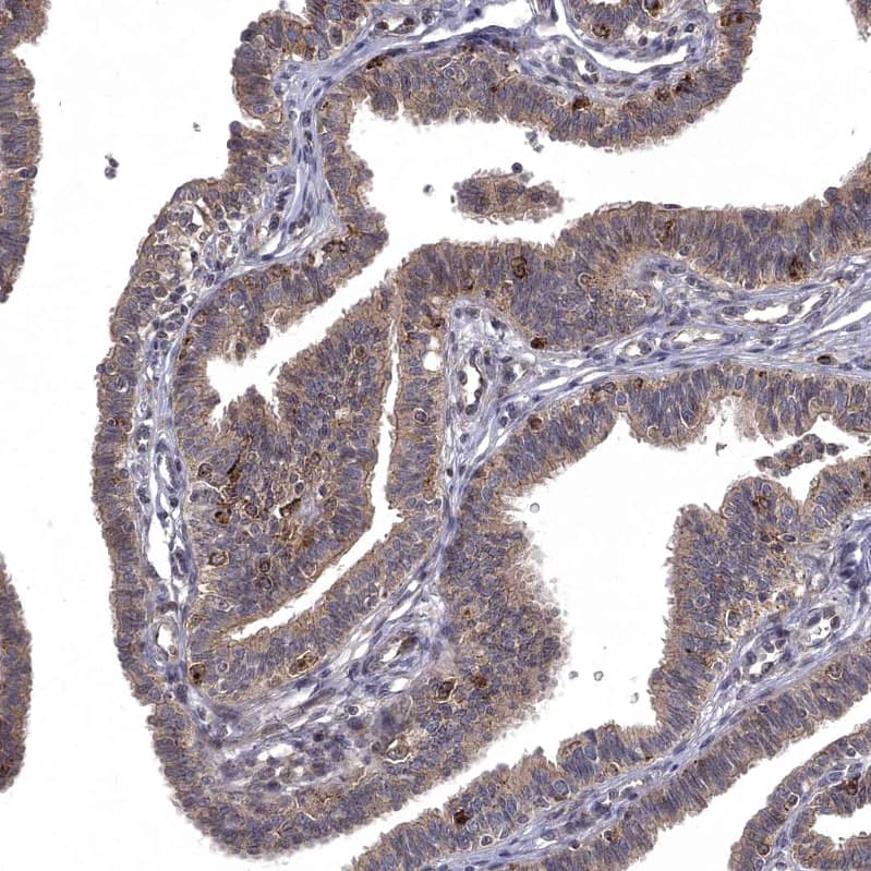 Staining of human fallopian tube shows moderate cytoplasmic positivity in glandular cells.