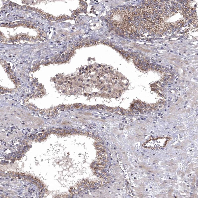 Staining of human prostate shows moderate cytoplasmic positivity in glandular cells.
