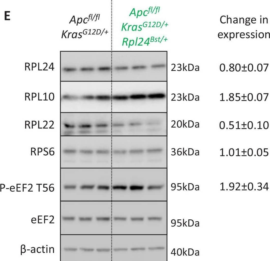 The effect of Rpl24Bst mutation on translation and ribosome composition.(A) Representative polysome profiles from Apcfl/fl KrasG12D/+ or Apcfl/fl KrasG12D/+ Rpl24Bst/+ small intestinal organoid cultures, pre-treated with harringtonine for 5 min/300 s (H300) or untreated (H0). These traces were analysed for the run-off rates shown in Figure 3E. (B) Representative polysome profiles from Apcfl/+ KrasG12D/+ or Apcfl/+ KrasG12D/+ Rpl24Bst/+ colonic adenoma cultures (left) and quantification of the polysome to subpolysome ratio from these (right). Two biologically independent lines were analysed per genotype and plotted +/- standard error of the mean (SEM). Scheme above denotes the generation of adenoma cultures from distinct colonic tumours in aged VillinCreER Apcfl/+ KrasG12D/+ and VillinCreER Apcfl/+ KrasG12D/+ Rpl24Bst/+ mice. (C) Relative protein synthesis rates quantified by 35S-methionine incorporation in the colonic adenoma cultures described in (B) with n = 3. The average protein synthesis rates were plotted relative to Apcfl/+ KrasG12D/+ controls (=1) for three organoid lines per genotype +/- SEM. Significance was determined by Mann–Whitney U test. (D) 60S to 40S ratio from sucrose density gradients from lysates generated from the indicated genotypes. Data show the mean +/- SEM. Representative traces are shown in Figure 3B and Figure 4—figure supplement 2B. (E) Western blotting from protein lysates generated from three biologically independent organoid lines for each genotype. Mean values for RPL24, RPL10, RPL22, and RPS6 expression relative to  beta -actin and P-eEF2 T56 relative to eEF2 are shown next to the relevant blot +/- SEM. The average of the VillinCreER Apcfl/+ KrasG12D/+ lanes in all cases has been set to 1. Image collected and cropped by CiteAb from the following open publication (//elifesciences.org/articles/69729), licensed under a CC-BY license. Not internally tested by Novus Biologicals.