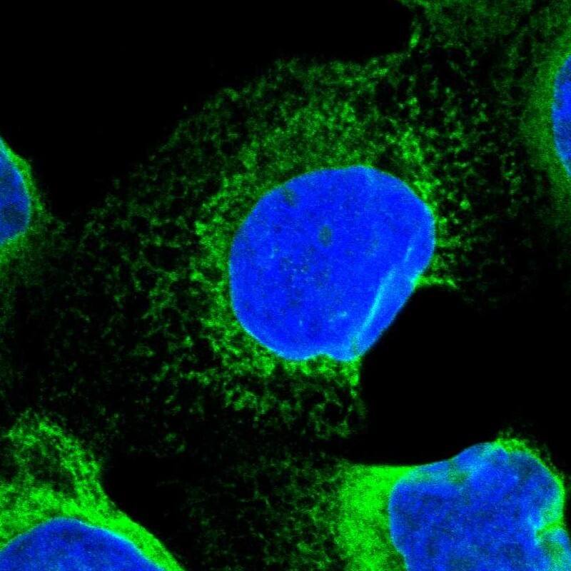 Staining of human cell line A-431 shows positivity in endoplasmic reticulum.