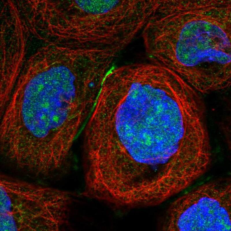 Immunocytochemistry/ Immunofluorescence TSR2 Antibody - BSA Free