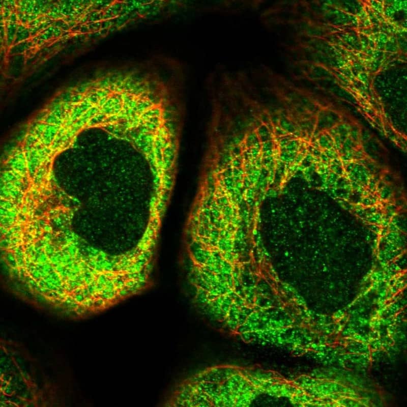 Staining of human cell line A-431 shows positivity in cytoplasm.