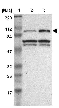 Lane 1: Marker [kDa] 220, 112, 84, 47, 32, 26, 17Lane 2: Human cell line RT-4Lane 3: Human cell line U-251MG sp