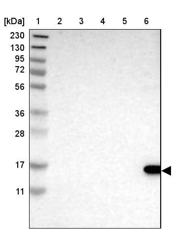 Western Blot TCL1A Antibody