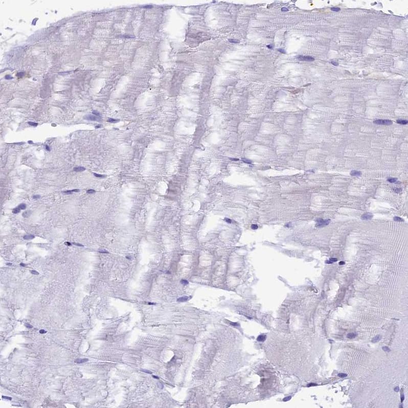 Immunohistochemistry-Paraffin IGSF6/DORA Antibody - BSA Free