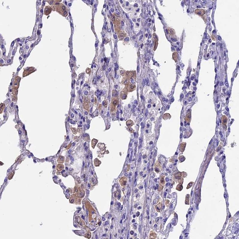 Immunohistochemistry-Paraffin IGSF6/DORA Antibody - BSA Free