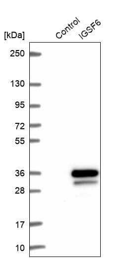 Western Blot IGSF6/DORA Antibody - BSA Free