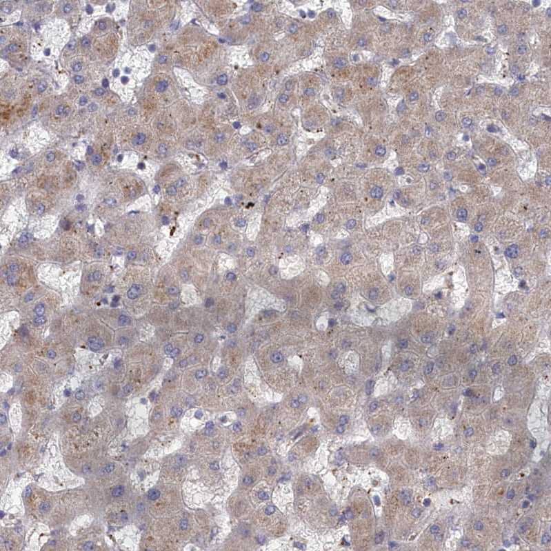 Staining of human liver shows moderate cytoplasmic positivity in hepatocytes.