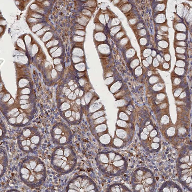 Staining of human small intestine shows strong cytoplasmic positivity in glandular cells.