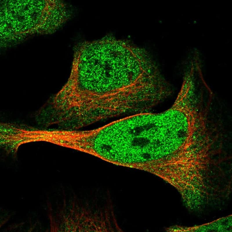 Immunocytochemistry/ Immunofluorescence DMTF1 Antibody - BSA Free