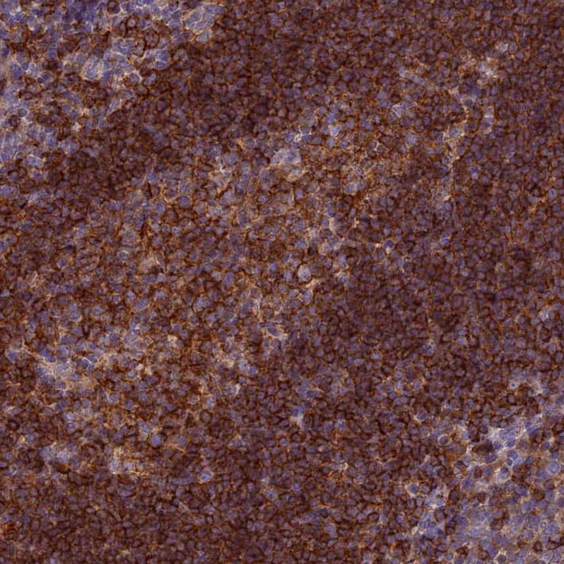 Staining of human tonsil shows strong membranous positivity in germinal center and non-germinal center cells.