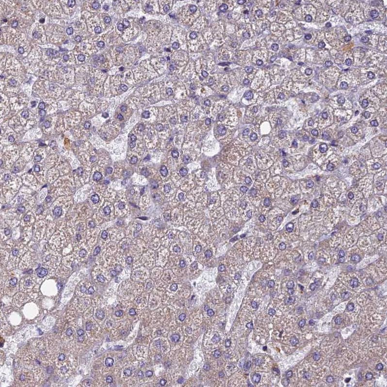 Staining of human liver shows no positivity in human liver as expected.