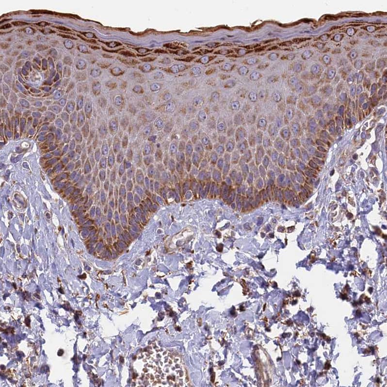 Staining of human skin shows moderate cytoplasmic granular positivity in squamous epithelial cells.