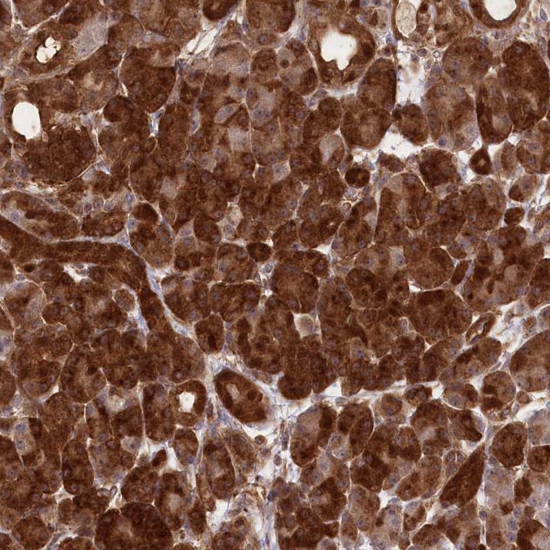 Immunohistochemistry-Paraffin CCDC91 Antibody - BSA Free