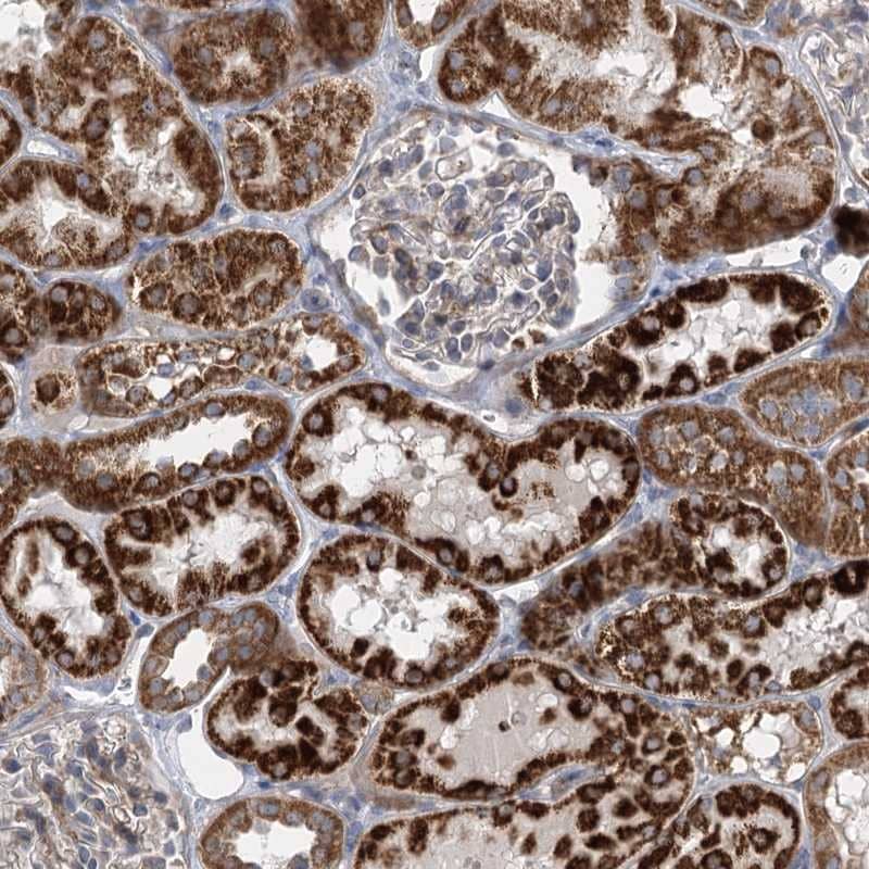 Staining of human kidney shows strong cytoplasmic positivity in cells of tubules.