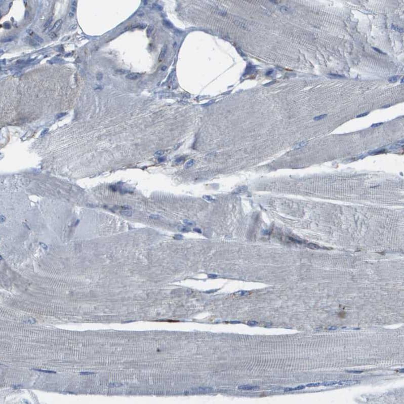 Staining of human skeletal muscle shows no positivity in myocytes as expected.