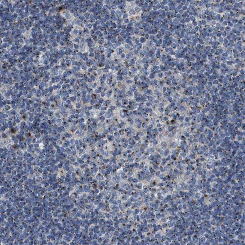 Staining of human lymph node shows strong cytoplasmic positivity in germinal center cells.
