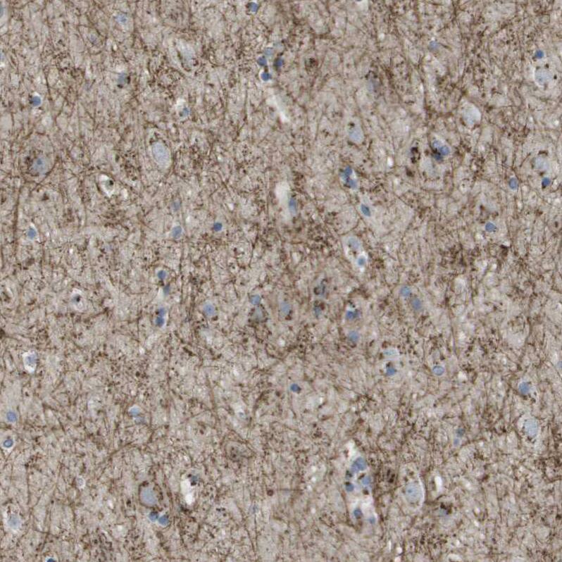 Staining of human cerebral cortex shows strong cytoplasmic positivity in neuronal processes