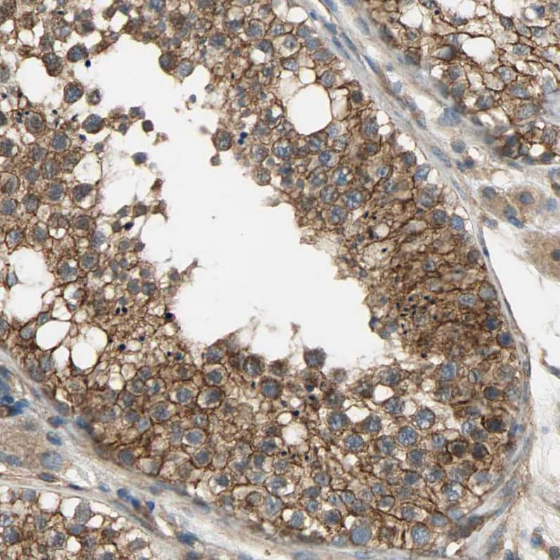 Immunohistochemistry-Paraffin SKT Antibody - BSA Free