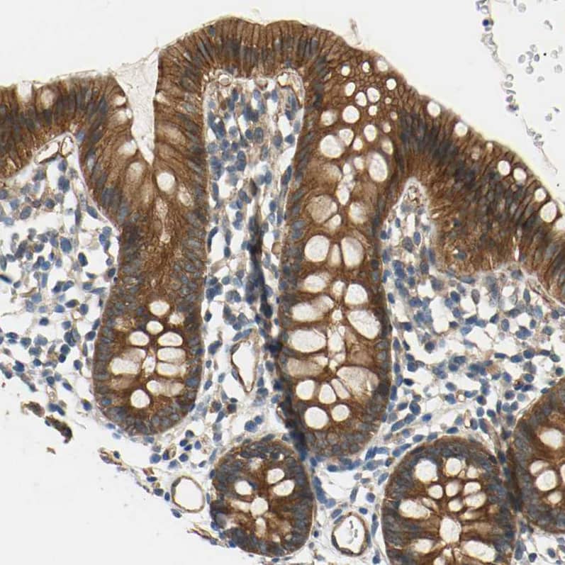 Immunohistochemistry-Paraffin SKT Antibody - BSA Free