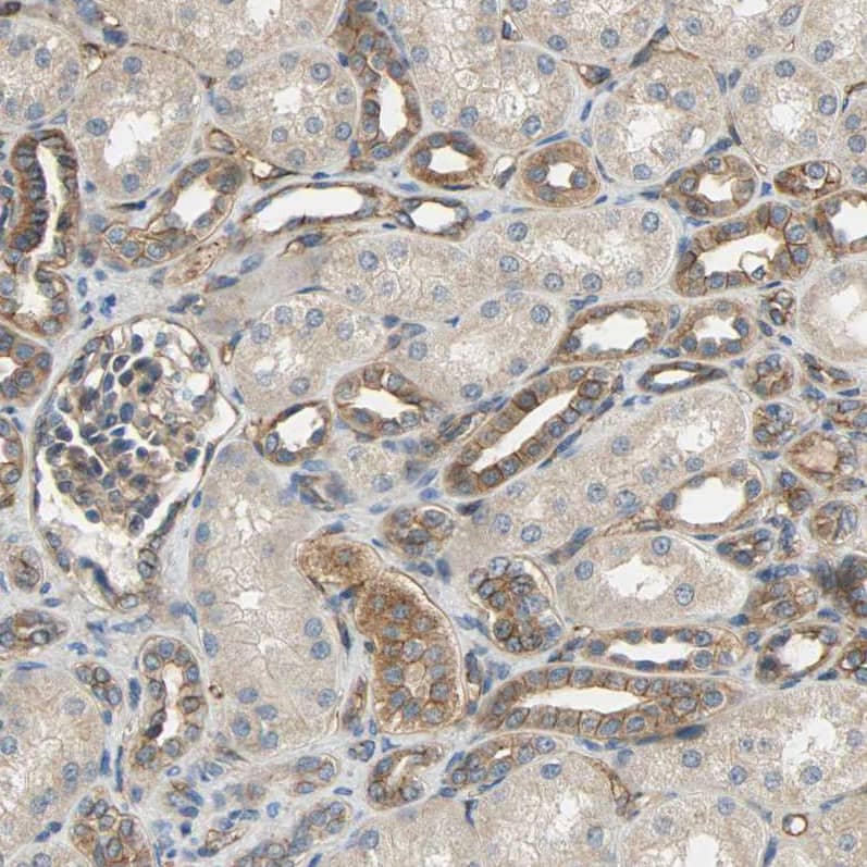 Immunohistochemistry-Paraffin SKT Antibody - BSA Free