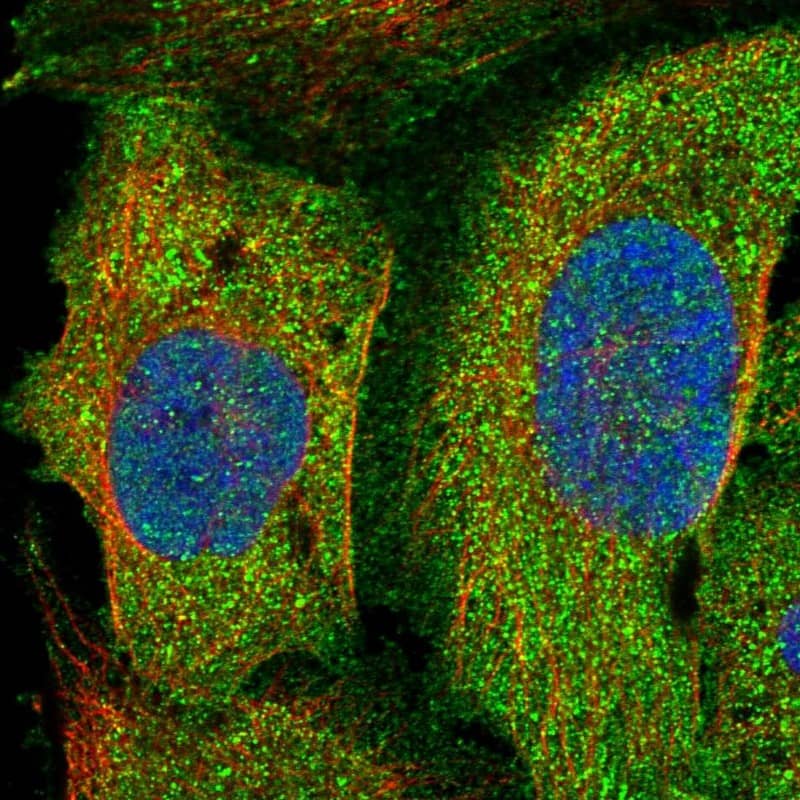 Immunocytochemistry/ Immunofluorescence PLEKHO2 Antibody - BSA Free