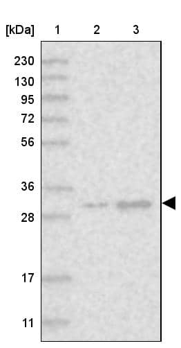 Lane 1: Marker [kDa] 230, 130, 95, 72, 56, 36, 28, 17, 11Lane 2: Human cell line RT-4Lane 3: Human cell line U-251MG sp